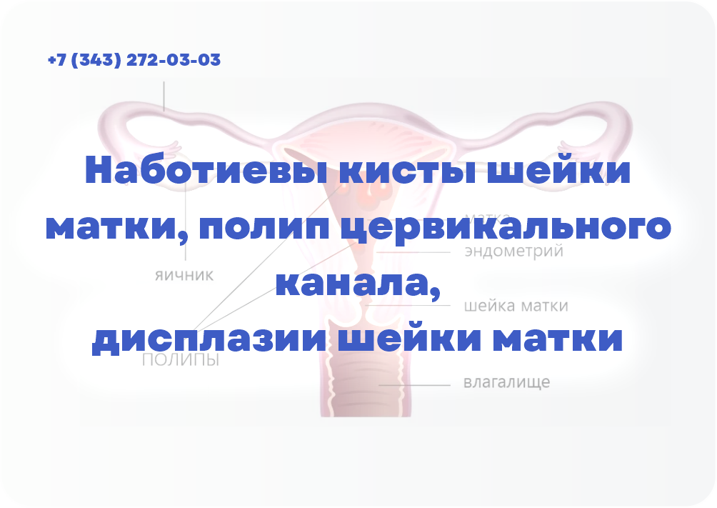Наботиевы кисты шейки матки, полип цервикального канала, дисплазии шейки матки