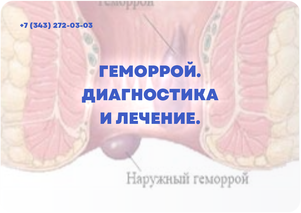 ГЕМОРРОЙ. ДИАГНОСТИКА И ЛЕЧЕНИЕ