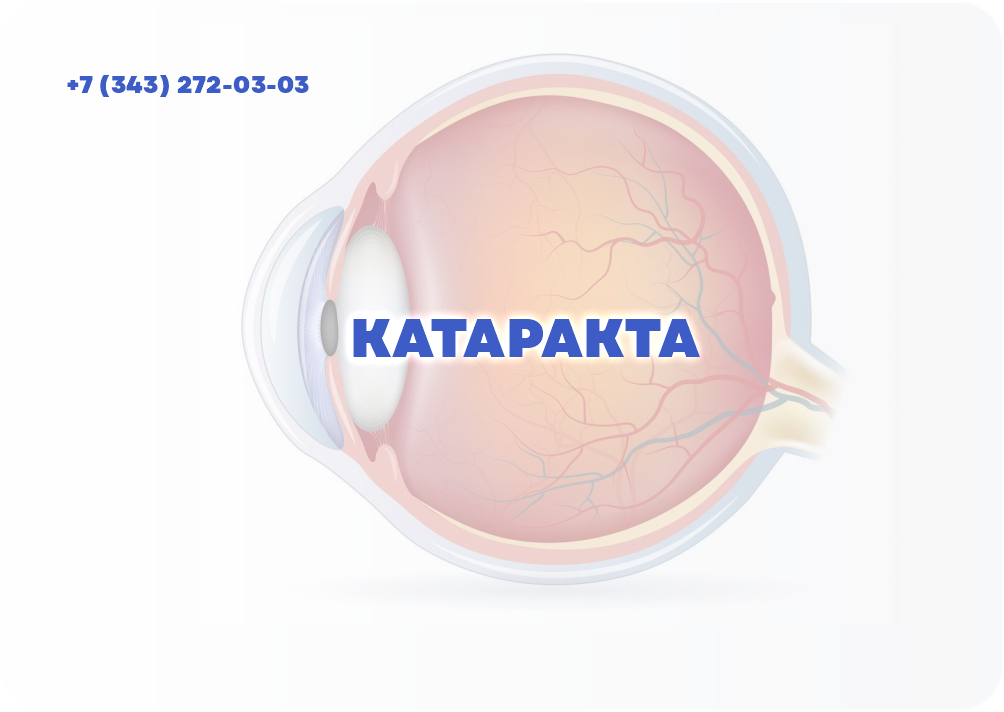 КАТАРАКТА