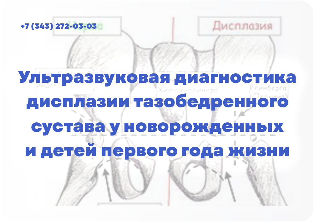 Ультразвуковая диагностика дисплазии тазобедренного сустава у новорожденных и детей первого года жизни