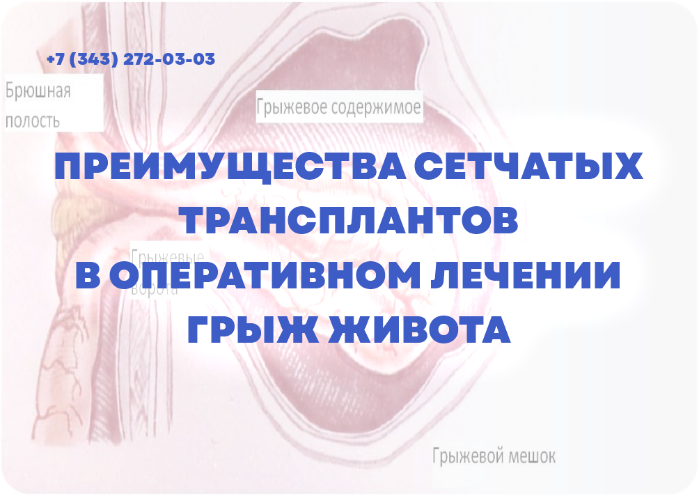 ПРЕИМУЩЕСТВА СЕТЧАТЫХ ТРАНСПЛАНТОВ В ОПЕРАТИВНОМ ЛЕЧЕНИИ ГРЫЖ ЖИВОТА.