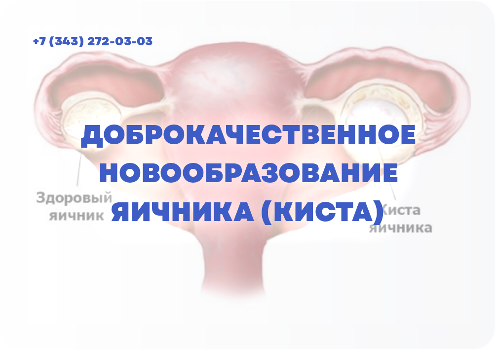 ДОБРОКАЧЕСТВЕННОЕ НОВООБРАЗОВАНИЕ ЯИЧНИКА (КИСТА)