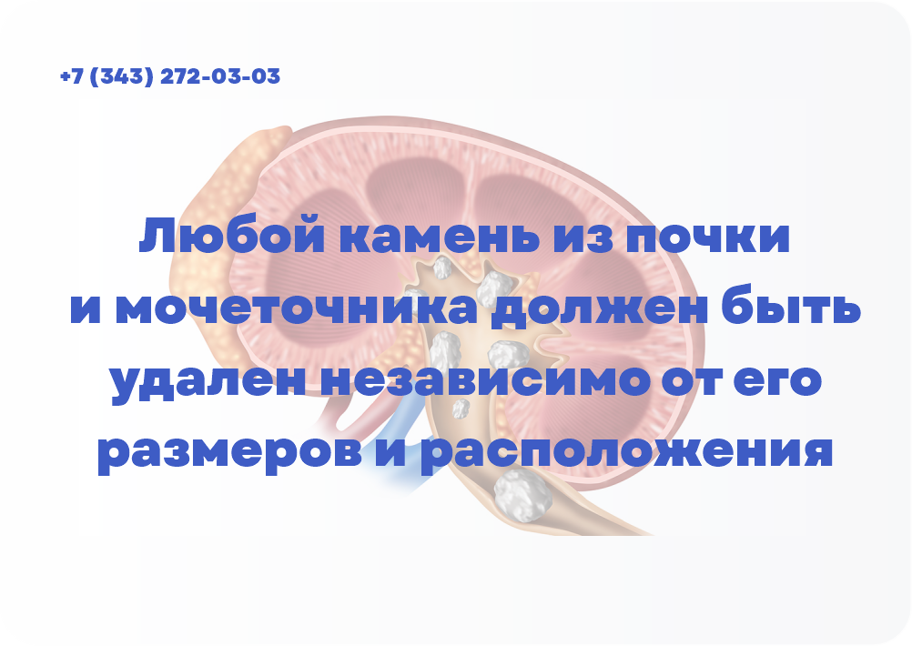 «Любой камень из почки и мочеточника должен быть удален независимо от его размеров и расположения»!