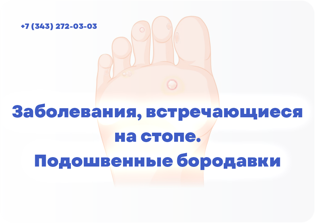 Заболевания, встречающиеся на стопе. Подошвенные бородавки