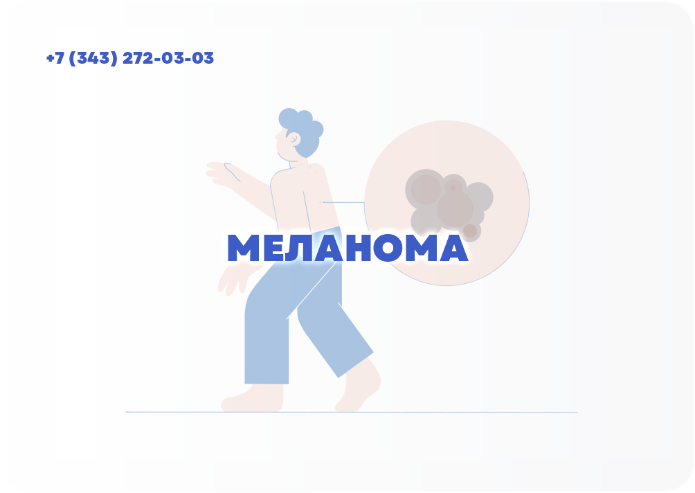 Меланома