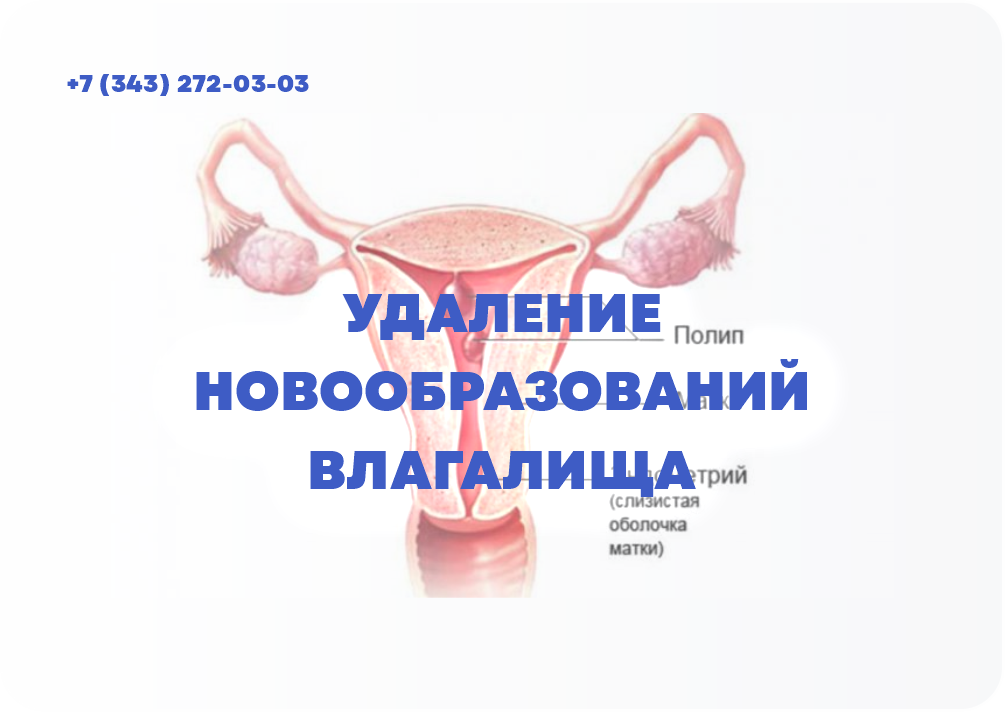 УДАЛЕНИЕ НОВООБРАЗОВАНИЙ ВЛАГАЛИЩА